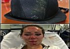 Thank You Helmet !